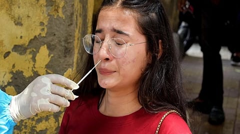 Representative Image