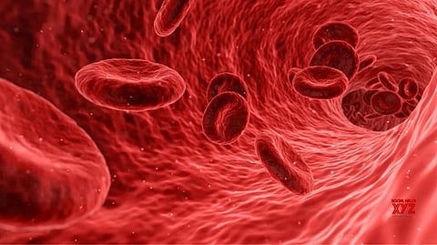 Representative Image