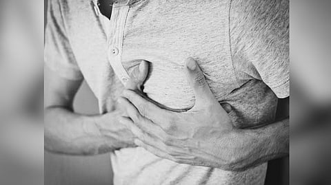 Representative image