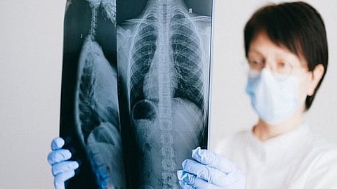 Representative image