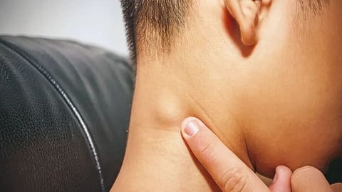 Representative Image