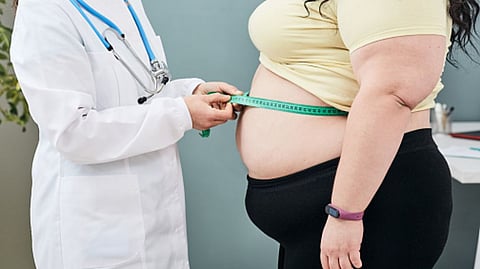 Representative image