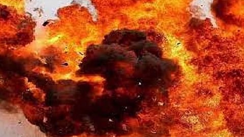 Representative Image