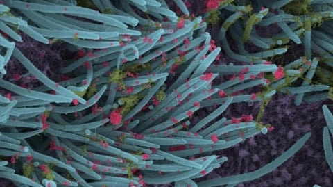 Representative image