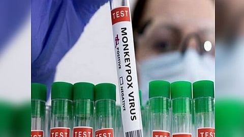 Representative image