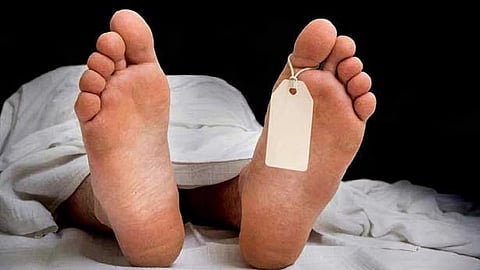 Representative Image