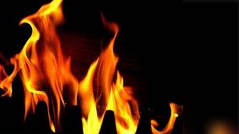 Representative Image