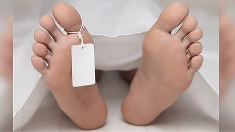 Representative Image