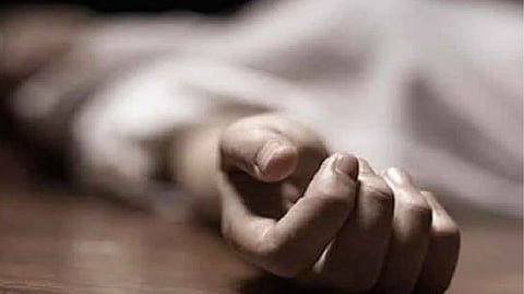 Representative image