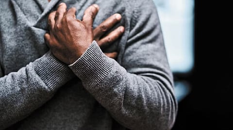 Representative image