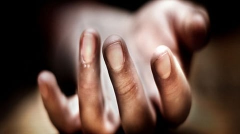 Representation Image