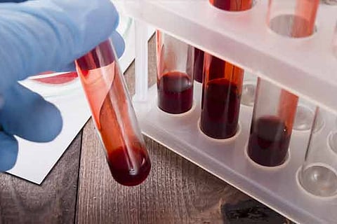 Representative Image