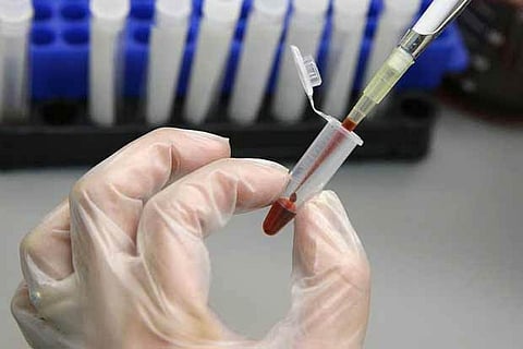 Representative Image