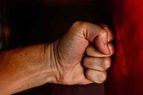 Representative image