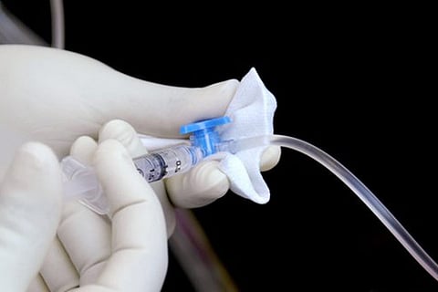 Representative image