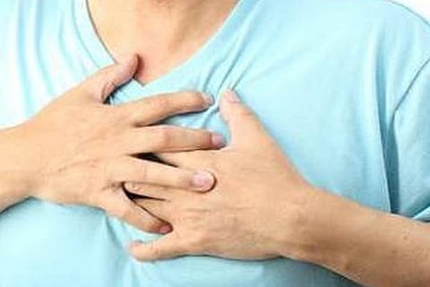 Representative Image