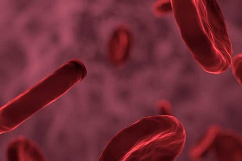 Representative Image