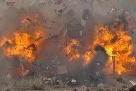 Representative Image