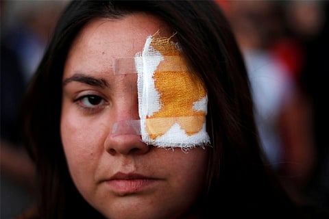 Protestor wearing a eye-patch in support of student Gustavo Gatica