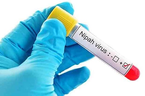 Suspected Nipah patient critical