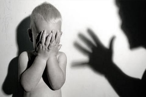 Representational image