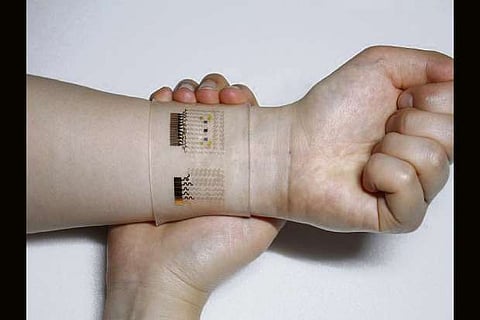 Representative Image