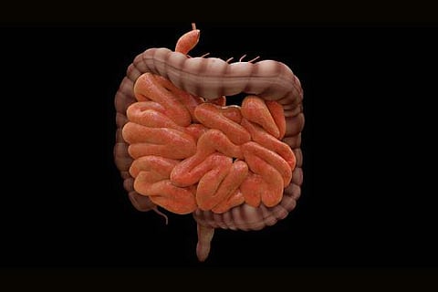 We feel full because stretched intestine tells us so