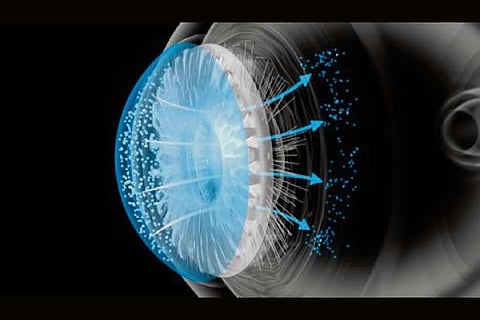 Representative Image