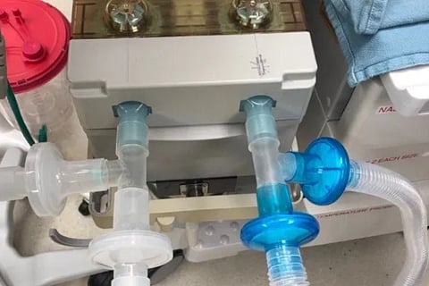 ICF calls for EoI from ventilator makers