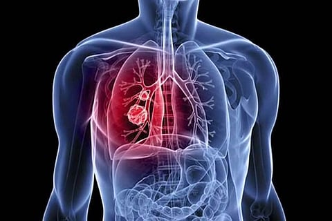 How corona-recovered patients can improve lung function