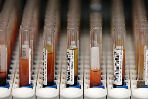 Centre denies it lifted ban on hydroxychloroquine under US threat