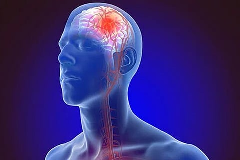 Representative image