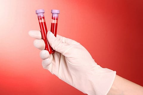 Blood test (Representative Image)