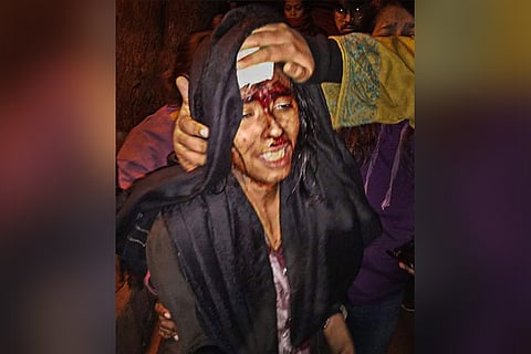 JNUSU President Aishe Ghosh injured after being attacked