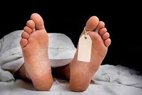 Representative Image