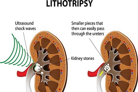 Ask the Doctor: Invisible aligners are more versatile for usage than conventional braces