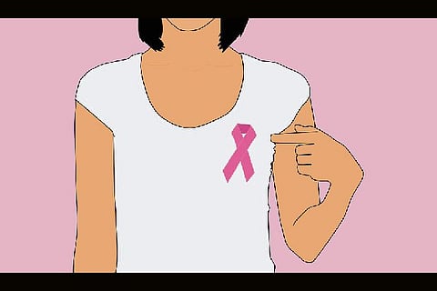 Galactorrhea affects 24 per cent women, not linked to breast cancer