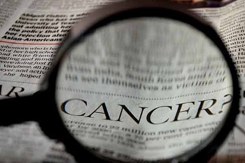 Shortness of breath, cough may be early signs of lung cancer