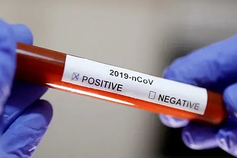 198 more test corona positive in J and K