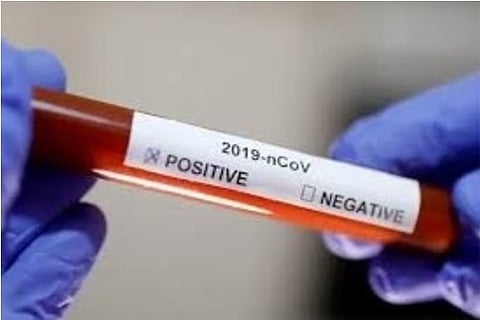 US Covid-19 cases surpass 2.8 million