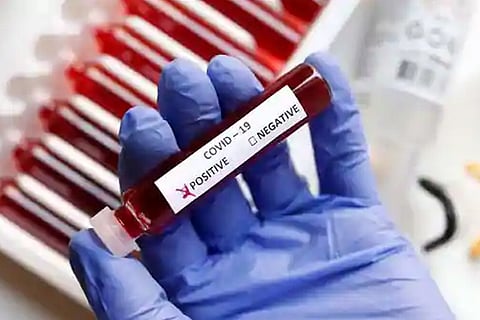 Three die of COVID-19 in Puducherry