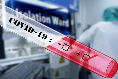 Testing COVID-19 positive: Advised home care for mild cases