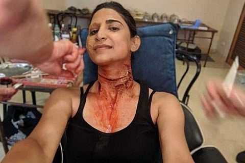 Aahana Kumra on wearing prosthetics in 'Betaal'