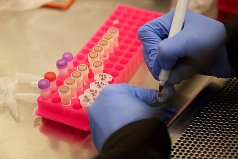 Loss of smell and taste listed as official COVID-19 symptoms in India