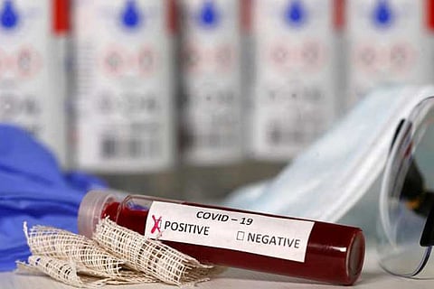 Representative image