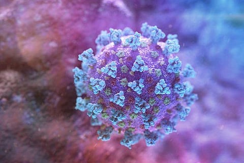 Representative Image