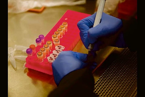 Anti-malarial drug hydroxychloroquine approved for high-risk corona cases