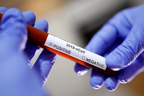 'Coronavirus could become seasonal, vaccine is critical': experts