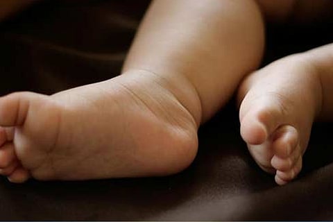 Representative Image