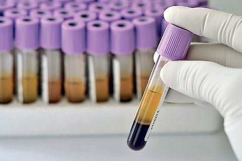 MMC, Madurai GH to begin clinical trials on plasma